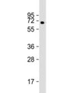 Western blot testing of human pancreas lysate with MGAT4B antibody at 1:2000. Predicted molecular weight ~63 kDa but may be observed at higher molecular weights due to glycosylation.