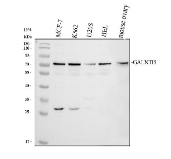 Western blot analysis of GALNT15 using anti-GALNT15 antibody. Electrophoresis was performed on a 10% SDS-PAGE gel at 80V (Stacking gel) / 120V (Resolving gel) for 2 hours. Lane 1: human MCF-7 whole cell lysates, Lane 2: human K562 whole cell lysates, Lane 3: human U2OS whole cell lysates, Lane 4: human HEL whole cell lysates, Lane 5: mouse ovary tissue lysates. After electrophoresis, proteins were transferred to a nitrocellulose membrane at 150 mA for 50-90 min.