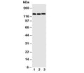 Western blot testing of VE Cadherin antibody; Lane 1: A549; 2: HeLa; 3: MCF-7 cell lysate. Expected molecular weight: 90~140 kDa depending on glycosylation level.