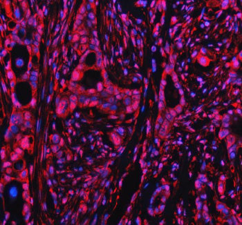 Immunofluorescent staining of PPP1R8 using anti-PPP1R8 antibody (green). PPP1R8 was detected in an immunocytochemical section of Hela cells. Enzyme antigen retrieval was performed using IHC enzyme antigen retrieval reagent for 15 mins. The cells were blocked with 10% goat serum. And then incubated with 5 ug/ml rabbit anti-PPP1R8 antibody overnight at 4oC. DyLight 488 Conjugated Goat Anti-Rabbit IgG was used as secondary antibody at 1:500 dilution and incubated for 30 min at 37oC.