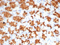IHC staining of FFPE human stomach tissue with Interleukin-2 antibody (clone IL2/4985). HIER: boil tissue sections in pH 9 10mM Tris with 1mM EDTA for 20 min and allow to cool before testing.