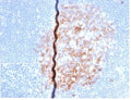 IHC staining of FFPE human lymph node with recombinant CD86 antibody (clone rC86/6872) at 2ug/ml in PBS for 30min RT. Negative control inset: PBS instead of primary antibody to control for secondary binding. HIER: boil tissue sections in pH 9 10mM Tris with 1mM EDTA for 20 min and allow to cool before testing.