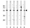 Western blot testing of 1) human HEK293, 2) human U-2 OS, 3) human U-87 MG, 4) human Y79, 5) mouse kidney and 6) mouse eyeball tissue lysate with FOXD1 antibody. Predicted molecular weight ~46 kDa.
