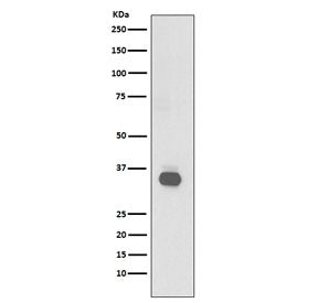 Western blot testing of human Raji cell lysate with CD20 antibody. Predicted molecular weight ~33 kDa.