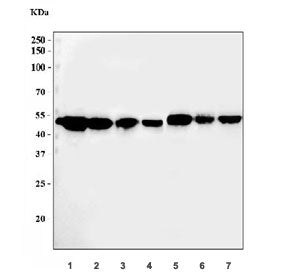 Western blot testing of 1) rat liver, 2) rat kidney, 3) rat stomach, 4) rat PC-12, 5) mouse kidney, 6) mouse stomach and 7) mouse NIH 3T3 cell lysate with ADK antibody. Expected molecular weight: 40-45 kDa.