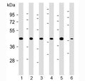 Western blot testing of 1) human 293, 2) (h) HeLa, 3) (h) MDA-MB-231, 4) rat H-4-II-E, 5) (h) HCT-116 and 6) mouse C2C12 cell lysate with TBP antibody at 1:2000. Expected molecular weight: 35-43 kDa.