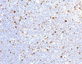 IHC testing of FFPE human lymph node with recombinant MCM7 antibody (clone MMCC7-1R). Required HIER: boil tissue sections in pH 9 10mM Tris with 1mM EDTA for 10-20 min.