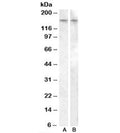 Western blot testing of human amygdala lysate with AVPR1B antibody, cat # R35132 (0.5ug/ml, lane A) and rat brain lysate with AVPR1B antibody, <a href=../tds/avpr1b-antibody-r34558>cat # R34558</a> (0.05ug/ml, lane B). Predicted molecular weight: ~47/170kDa (unmodified/modified).