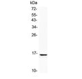 Western blot testing of human SK-OV-3 cell lysate with NPC2 antibody at 0.5ug/ml. Predicted molecular weight: ~17 kDa, can be observed as a ~21/23 kDa doublet in human samples. (Ref 1).