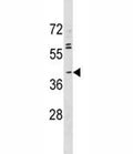 ABO antibody western blot analysis in MDA-MB231 lysate