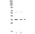 Western blot testing of human 1) HeLa and 2) SW620 cell lysate with IL12 p35 antibody at 0.5ug/ml. Predicted molecular weight ~25 kDa (unmodified), ~35 kDa (glycosylated).