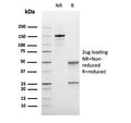 SDS-PAGE analysis of purified, BSA-free recombinant Bcl6 antibody (clone rBCL6/1475) as confirmation of integrity and purity.