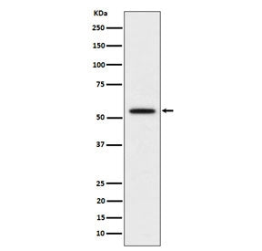 Western blot testing of human Hela cell lysate with KATNA1 antibody. Predicted molecular weight ~56 kDa.