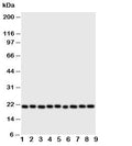 Western blot testing of Cytoglobin antibody and Lane 1: rat brain; 2: (r) small intestine; 3: (r) liver; 4: (r) kidney; 5: human SGC; 6: (h) COLO320; 7: SMMC-7721; 8: PANC; 9: HeLa cell lysate. Predicted/observed molecular weight: ~21 kDa.