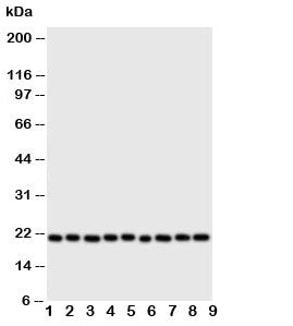 Western blot testing of Cytoglobin antibody and Lane 1: rat brain; 2: (r) small intestine; 3: (r) liver; 4: (r) kidney; 5: human SGC; 6: (h) COLO320; 7: SMMC-7721; 8: PANC; 9: HeLa cell lysate. Predicted/observed molecular weight: ~21 kDa.