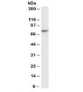 Western blot testing of Jurkat lysate with SLP76 antibody at 0.3ug/ml. Expected molecular weight: ~76kDa.