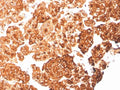 IHC staining of FFPE human pancreas with recombinant Cytokeratin 6A antibody (clone rKRT6A/2100). HIER: boil tissue sections in pH 9 10mM Tris with 1mM EDTA for 20 min and allow to cool before testing.