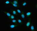 Immunofluorescent staining of FFPE human PC-3 cells with IAH1 antibody (green) and DAPI nuclear stain (blue). HIER: steam section in pH6 citrate buffer for 20 min.