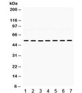Western blot testing of 1) rat heart, 2) rat brain, 3) rat liver, 4) mouse liver, 5) mouse lung, 6) human 22RV1, and 7) human SMMC lysate with ADRA1A antibody. Expected/observed molecular weight ~52 kDa.