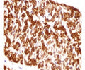 DES / Desmin antibody immunohistochemistry analysis in formalin fixed and paraffin embedded human heart tissue.