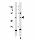 Western blot testing of E2F1 antibody at 1:1000 dilution. Lane 1: NIH3T3 lysate; 2: A431; Predicted molecular weight: 48-60 kDa.