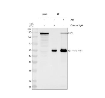 Immunoprecipitating ERC1 in Hela whole cell lysate. Western blot analysis of ERC1 using anti-ERC1 antibody. Lane 1: Hela whole cell lysates (30ug), Lane 2: Rabbit control IgG instead of anti-ERC1 antibody in Hela whole cell lysate, Lane 3: anti-ERC1 antibody (2ug) + Hela whole cell lysate (500ug). After electrophoresis, proteins were transferred to a membrane.