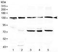 Western blot testing of 1) rat liver, 2) mouse liver, 3) human MCF7, 4) human COLO320 and 5) human HeLa lysate with CD133 antibody at 0.5ug/ml. Predicted molecular weight: ~97 kDa (unmodified), ~130 kDa (glycosylated).