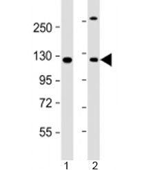 Western blot testing of human 1) A431 and 2) HeLa cell lysate with INTS6 antibody at 1:2000. Predicted molecular weight: 100 kDa.