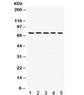 Western blot testing of 1) rat brain, 2) mouse stomach, human 3) HeLa, 4) U87 and 5) SKOV lysate with LIMK antibody. Expeccted/observed molecular weight ~72 kDa.