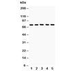 Western blot testing of 12 Lipoxygenase antibody and Lane 1: A549; 2: MCF-7; 3: COLO320; 4: Jurkat; 5: HeLa; Predicted size: 75KD; Observed size: 75KD