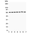 Western blot testing of ANG1 antibody and Lane 1: HeLa; 2: MCF-7; 3: COLO320; 4: A549; 5: HEPG2; 6: 293T; 7: SW620. Observed size 57~75KD depending on glycosylation level
