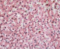 IHC testing of FFPE human liver with ITIH4 antibody at 4ug/ml. HIER: steamed with pH6 citrate buffer, AP-staining.