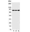 Western blot testing of TrkA antibody and Lane 1: COLO320; 2: HT1080; 3: U87 cell lysate. Observed molecular weight: 85~140 kDa depending on glycosylation level.