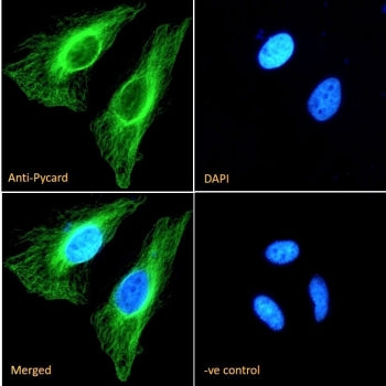 Immunofluorescent staining of fixed and permeabilized human HeLa cells with ASC antibody (green) at 10ug/ml and DAPI nuclear stain (blue).