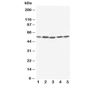 Western blot testing of KIM-1 antibody and human cell lysate 1: SMMC-7721; 2: HeLa; 3: PANC; 4: M231; 5: M453 cell lysate. Predicted molecular weight~39 kDa, routinely observed at ~55 kDa (Ref 1), and a heavily glycosylated mature form at ~100 kDa (Ref 2).