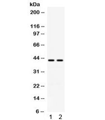 Western blot testing of human 1) A549 and 2) COLO320 cell lysate with RAD51C antibody. Expected molecular weight ~42 kDa.