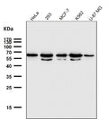 Western blot testing of human samples using the GTF2E1 antibody at 1:1000 dilution for 1 hour at room temperature. A dominant band is detected at ~60-65 kDa with a second band at ~50-55 kDa, although the calculated molecular weight is ~49 kDa. The higher-migrating species is consistent with hyper-phosphorylated TFIIE alpha during transcription initiation, while the lower band represents a less-phosphorylated form.