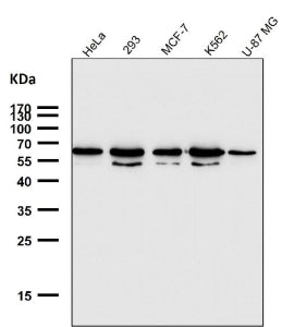 Western blot testing of human samples using the GTF2E1 antibody at 1:1000 dilution for 1 hour at room temperature. A dominant band is detected at ~60-65 kDa with a second band at ~50-55 kDa, although the calculated molecular weight is ~49 kDa. The higher-migrating species is consistent with hyper-phosphorylated TFIIE alpha during transcription initiation, while the lower band represents a less-phosphorylated form.