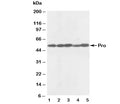 Western blot testing of anti-Caspase-8 antibody and Lane 1: rat thymus; 2: rat liver; 3: human MCF-7; 4: (h) HeLa; 5: (h) SMMC-7721 lysate. Predicted molecular weight: ~55 kDa (pro), ~40 kDa (large + small subunit), ~20 kDa (large subunit).