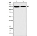 Western blot testing of 1) human HEK293 and 2) mouse NIH3T3 lysate with KDM4A antibody. Predicted molecular weight ~121 kDa.