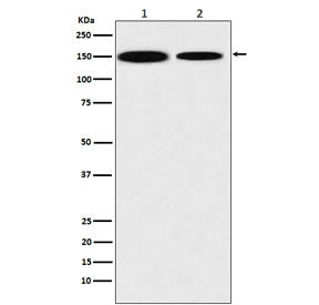 Western blot testing of 1) human HEK293 and 2) mouse NIH3T3 lysate with KDM4A antibody. Predicted molecular weight ~121 kDa.