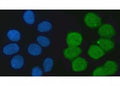 Immunofluorescent staining of FFPE human MCF7 cells with KHSRP antibody (green) and DAPI nuclear stain (blue). HIER: steam section in pH6 citrate buffer for 20 min.