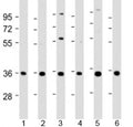 Western blot testing of human 1) A431, 2) HeLa, 3) HepG2, 4) Jurkat, 5) U-2OS and 6) SH-SY5Y cell lysate with NT5C3 antibody at 1:2000. Predicted molecular weight: 38 kDa.