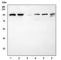 Western blot testing of 1) human Ramos, 2) human Daudi, 3) rat spleen, 4) mouse spleen, 5) mouse RAW264.7 and 6) mouse EL4 cell lysate with CD19 antibody at 0.5ug/ml. Expected molecular weight: 60~100 kDa depending on glycosylation level.