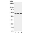 Western blot testing of 1) rat brain, 2) mouse NIH3T3 and 3) human HepG2 lysate with Cytokeratin 14 antibody at 0.5ug/ml. Predicted molecular weight ~53 kDa.