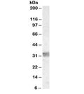 Western blot testing of human thymus lysate with MyD88 antibody at 0.03ug/ml. Predicted molecular weight ~33 kDa.