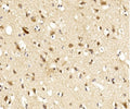 IHC testing of FFPE human brain tissue with Lingo1 antibody. HIER: steam section in pH6 citrate buffer for 20 min and allow to cool prior to staining.
