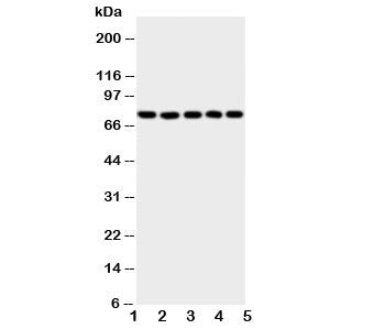 Western blot testing of 5-Lipoxygenase antibody and Lane 1: SW620; 2: Jurkat; 3: COLO320; 4: A549; 5: MCF-7 cell lysate. Predicted/observed size ~78KD