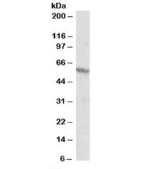 Western blot testing of A431 lysate and RXR beta antibody at 1ug/ml. Predicted molecular weight: ~57kDa but routinely observed at 57~60kDa.