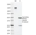 SDS-PAGE analysis of purified, BSA-free PP65 antibody (clone CMV101) as confirmation of integrity and purity.